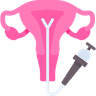 Hysteroscopy