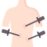 Laparoscopy